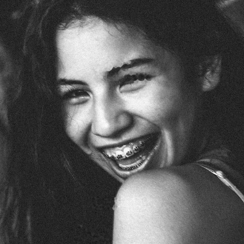 Joven riendo con brackets, en blanco y negro