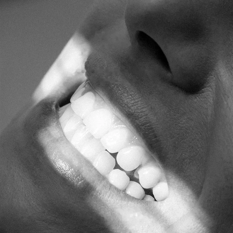 Sonrisa en blanco y negro con dientes blancos y luz lateral