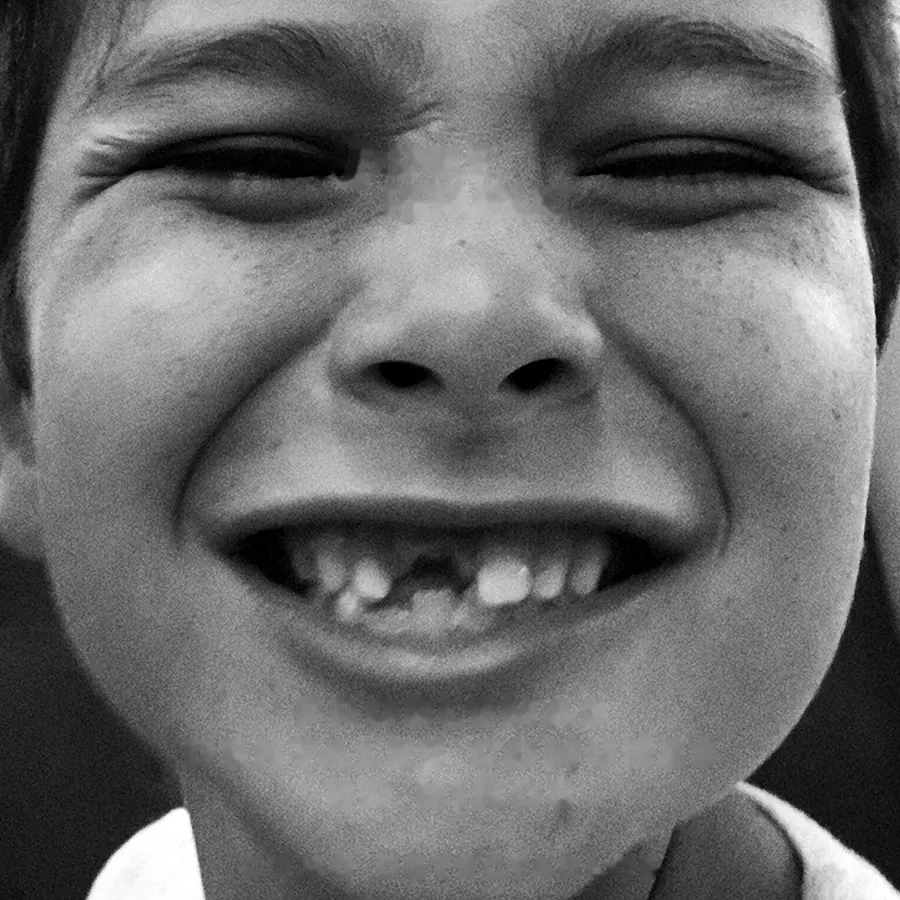 Niño riendo y mostrando sus dientes de leche, en blanco y negro